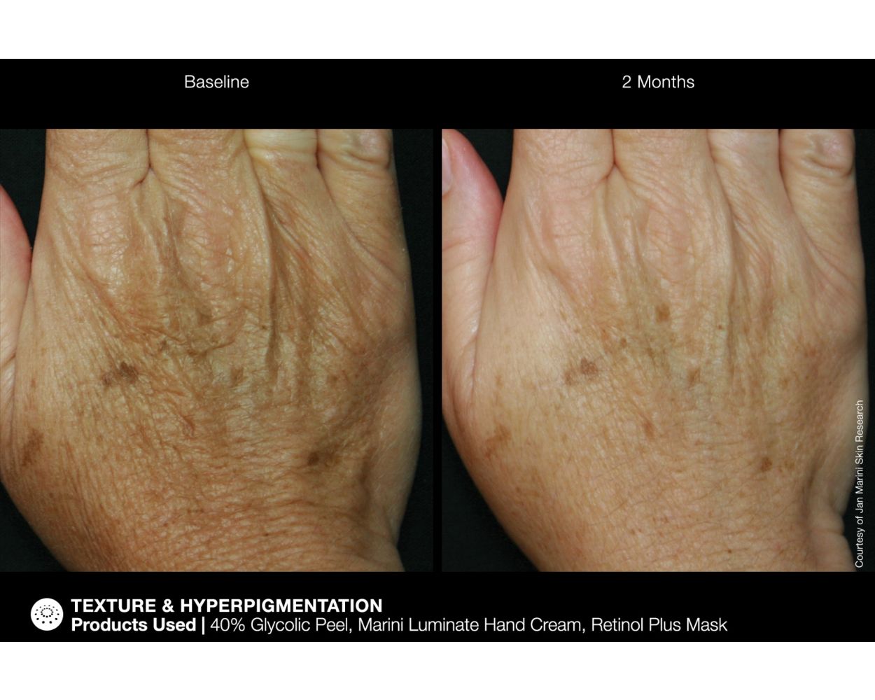 Jan Marini Renu Hand Complex
